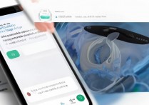 vivox5m怎么安装fish插件，vivox5m手机fish插件安装教程