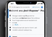 苹果支付怎么取消绑定的银行卡
